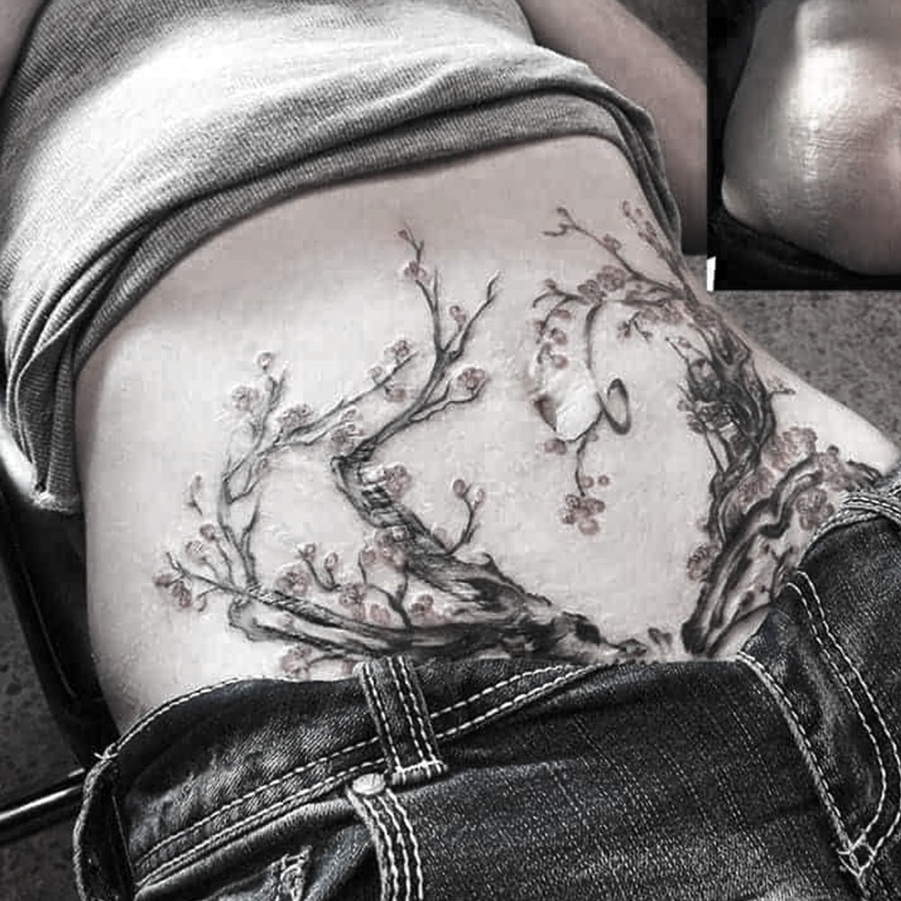 Can You Tattoo Over Scars? What Every Artist Needs to Know